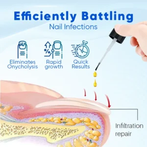 Biancat® OnyxoGuard Nail Growth and Repair Serum