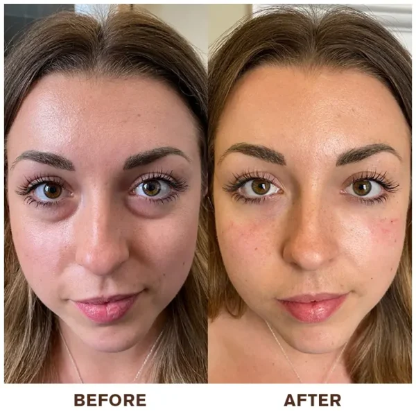 LIMETOW™ Instant Eye Cream Tightener