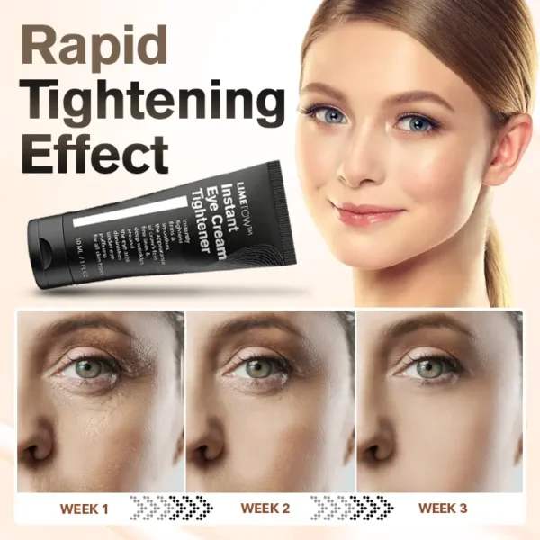 LIMETOW™ Instant Eye Cream Tightener