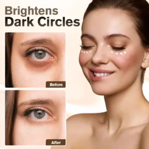 LIMETOW™ Instant Eye Cream Tightener