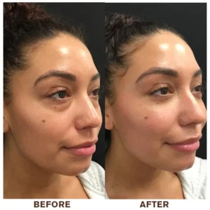 LIMETOW™ Instant Eye Cream Tightener