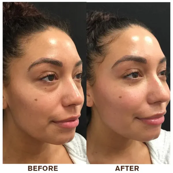 LIMETOW™ Instant Eye Cream Tightener