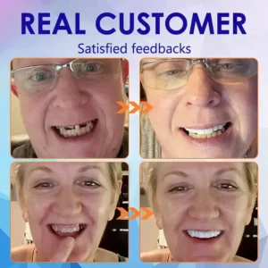 NESLEMY™ Advanced Customized Full Denture Set